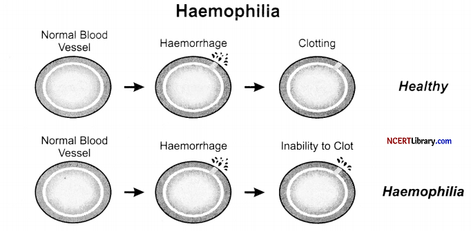 CBSE Sample Papers for Class 12 Biology Set 6 with Solutions Q32