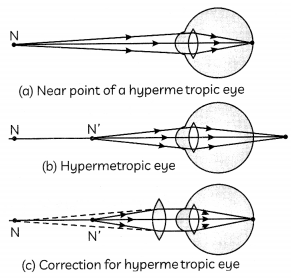 Defects of Vision 2